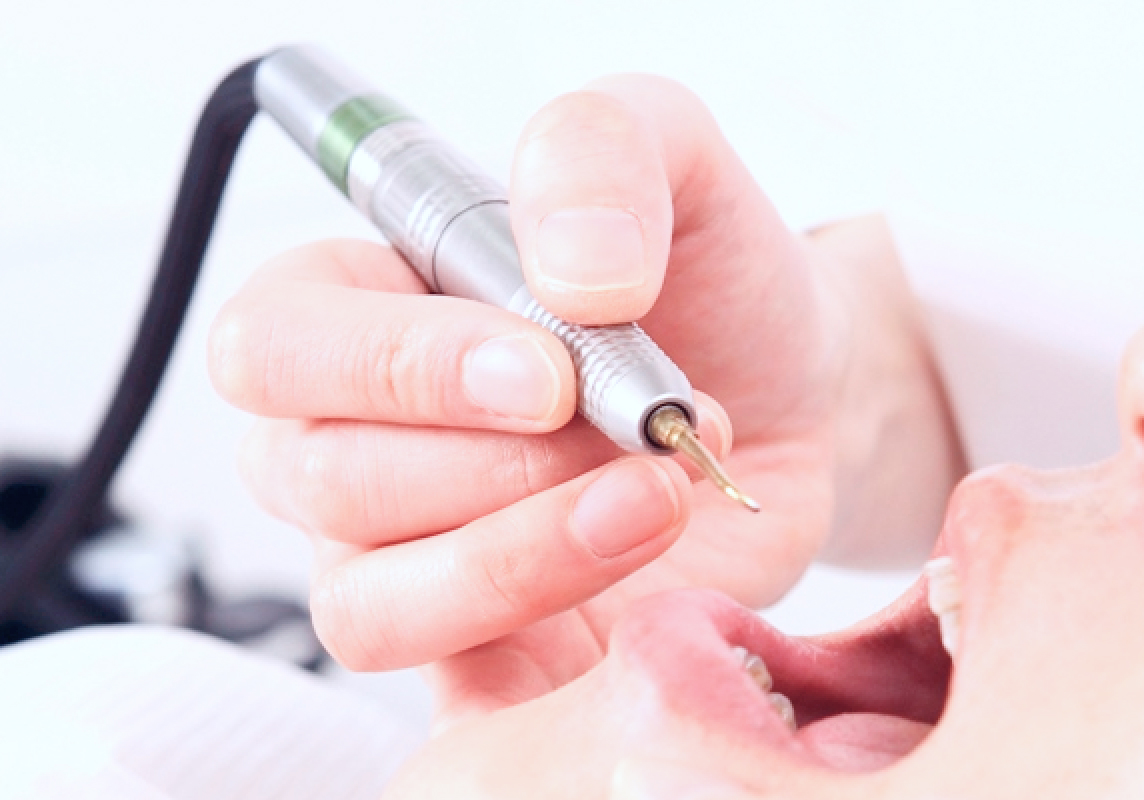 ホワイトエッセンスクリーニングの様子